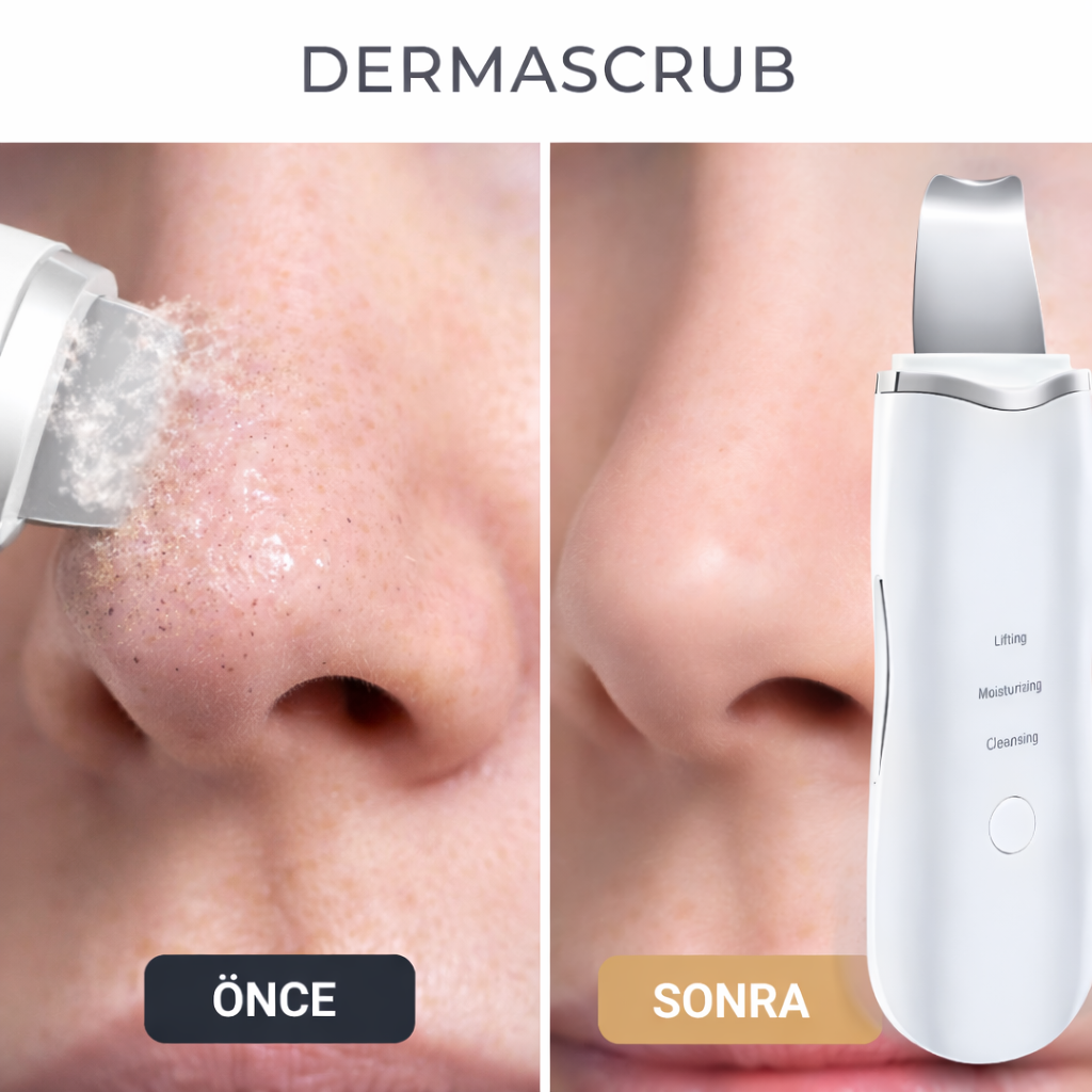 Edeloria DermaScrub™ – Titreşimli Derin Yüz Temizleme Cihazı