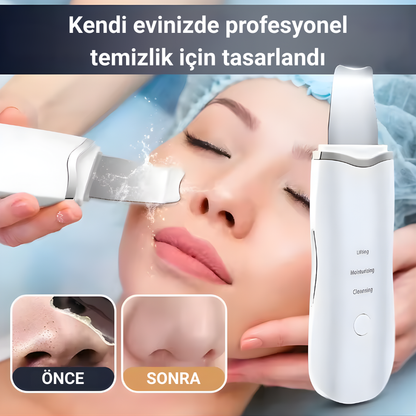 Edeloria DermaScrub™ – Titreşimli Derin Yüz Temizleme Cihazı
